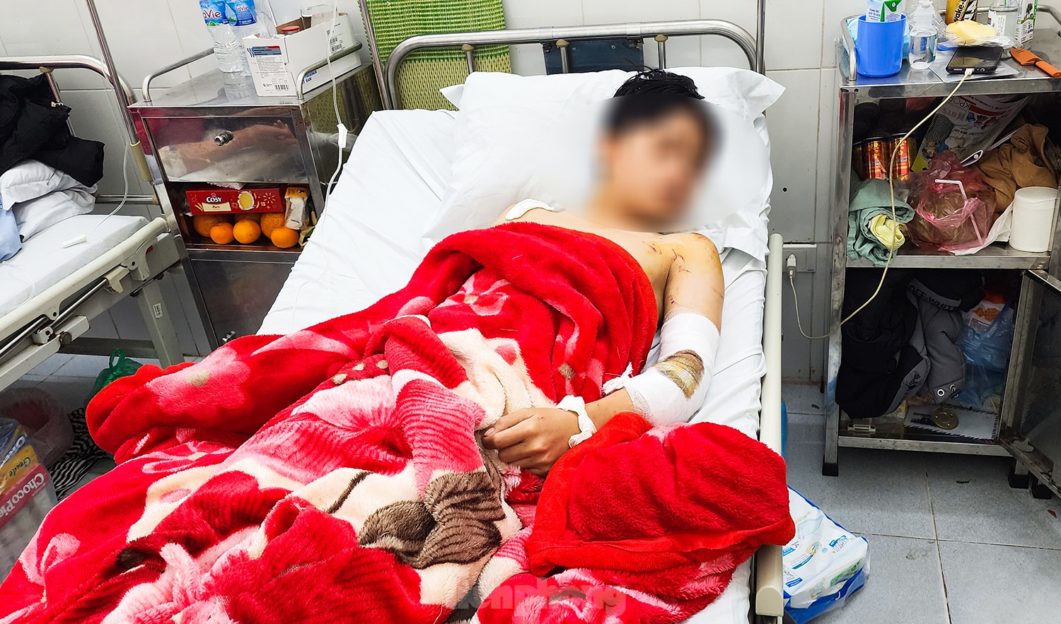 Nam sinh V. trong quá trình điều trị trấn thương Nam sinh V. trong quá trình điều trị trấn thương