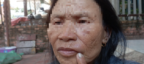 Cụ bà bán ngô bị một người phụ nữ bán đậu phụ đánh túi bụi
